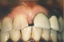 Teeth in need of a makeover
