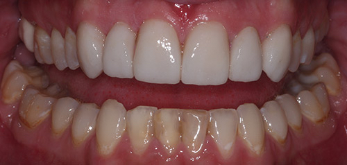 Cosmetic Dentistry in Smile Midtown Dental Clinic