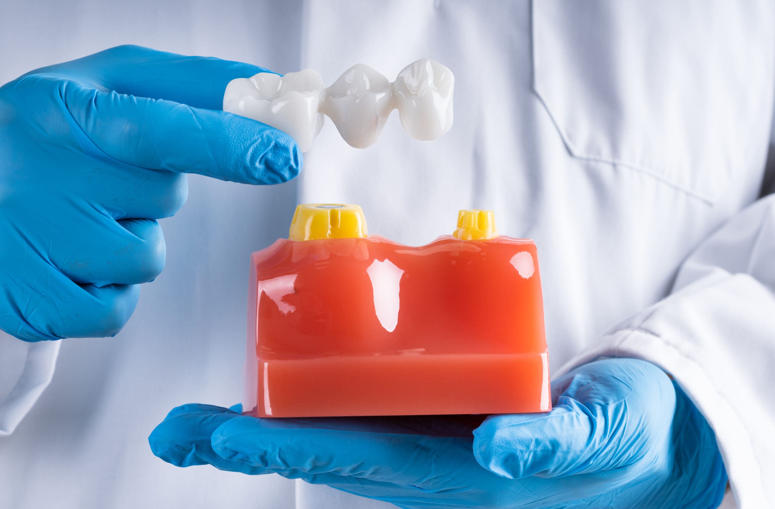 Different Types of Dentures Explained for 2024